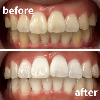 LBSホワイトニング 銀座店💎スタッフ峯のその他イメージ