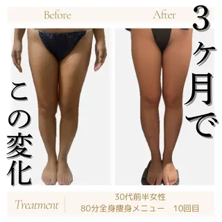 京橋 痩身エステ専門サロン BOSS  BODY所属・京橋痩身エステ専門サ ロンBOSSBODYのエステ・リラクイメージ