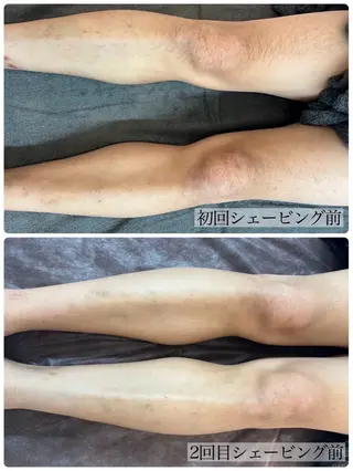 メンズ BelleMignon所属・Belle Mignonのエステ・リラクイメージ