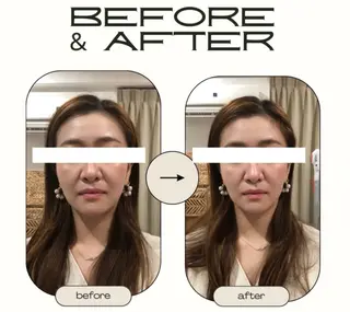 肩甲骨&全身オイル専門店　TENER 池袋所属・TENER 池袋 KANAKOのその他イメージ