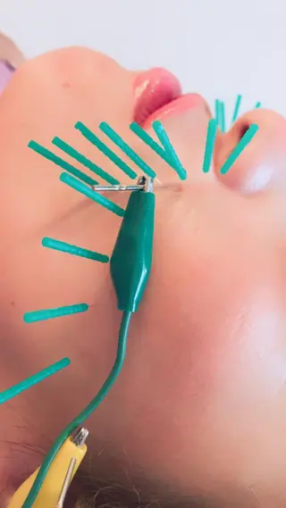 はりすたいる 鍼灸院のエステ・リラクイメージ