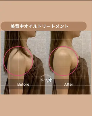 【頭痛、睡眠改善】 salon RUUのエステ・リラクイメージ