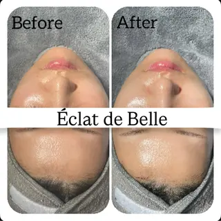 Éclat de Belle🫧白玉肌のエステ・リラクイメージ