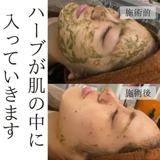 ハーブピーリング・毛穴ケア専門サロンSalon de LENA所属・ハーブピーリング 専門店/名古屋駅前店のエステ・リラクイメージ