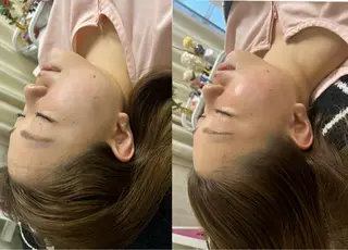 美容鍼灸サロン mahoroba院長のエステ・リラクイメージ