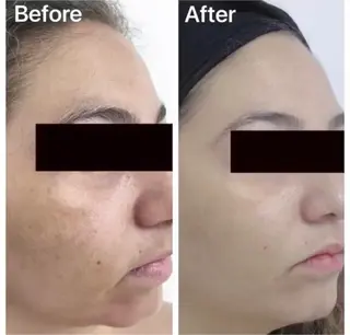 SMOOTH SKIN TOKYO.所属・SMOOTH SKIN SPA.のエステ・リラクイメージ