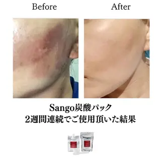 山城 悠菜のエステ・リラクイメージ