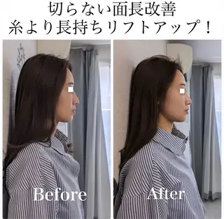 La　Beaute Verite所属・浅居 結菜のその他イメージ