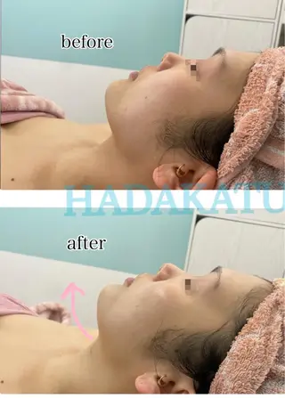 総合エステサロン 肌活のエステ・リラクイメージ