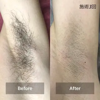 メンズ Mens Salon SOLEのエステ・リラクイメージ