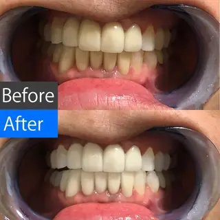 ミディアム カラー ネイル キッズ メンズ ヘアアレンジ パーマ マツエク・マツパ アイブロウ 中目黒 ホワイトニングサロンのその他イメージ