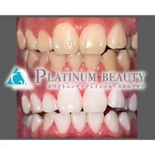 プラチナムビューティー柏所属・【歯科提携】柏ホワイ トニングスタイルのその他イメージ