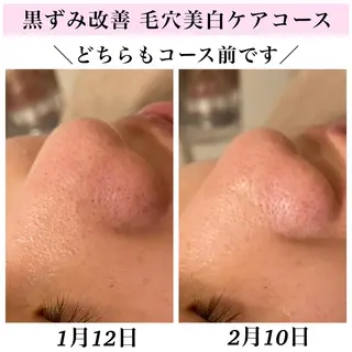 Bellesthe (ベルエステ)のエステ・リラクイメージ