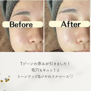 お肌と歯のサロン　Sona Mior所属・藤井 ののみのエステ・リラクイメージ