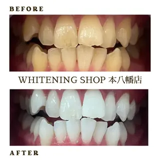メンズ ホワイトニング ショップ本八幡店のエステ・リラクイメージ