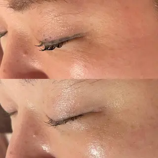 アンテインチル 山本のエステ・リラクイメージ