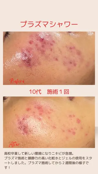 ベラージュ【美背中・ 美尻・フェイシャル】のエステ・リラクイメージ