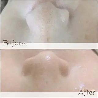 韓国肌＆毛穴洗浄 Beautsaineのエステ・リラクイメージ