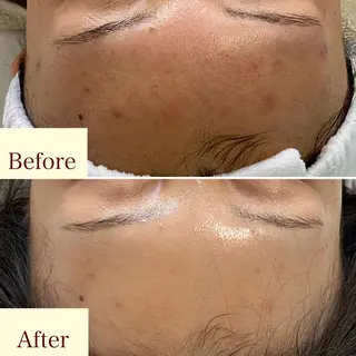 メンズ歓迎🙆‍♀️ エステ/ネイルISTのエステ・リラクイメージ