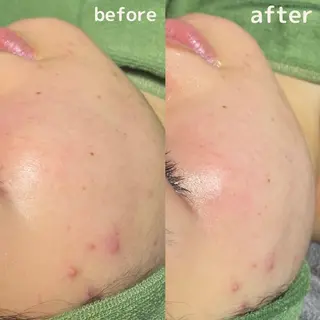 痩身・フェイシャル/if byOrabriller所属・if byOrab riller【イフ】のその他イメージ