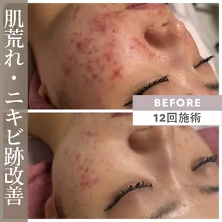 小顔矯正専門店 ❤️池田 桃花のエステ・リラクイメージ