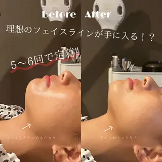 ショート 💎美容革命ラボ💎 大名店のエステ・リラクイメージ