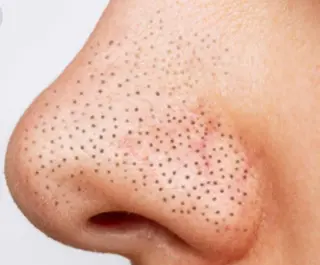 private salon  Dea_maris シュガーリング＆パーソナルボディケア所属・シミ改善・韓国肌管理 ボディメイク痩身のその他イメージ