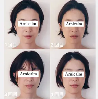 脳洗浄®︎・表参道 頭痛・睡眠改善ケアのエステ・リラクイメージ
