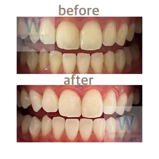 メンズ ホワイトニング ショップ本八幡店のエステ・リラクイメージ