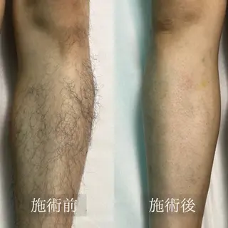 エステサロン　WABISABI所属・【美肌・脱毛専門店】 博多WABISABIのエステ・リラクイメージ