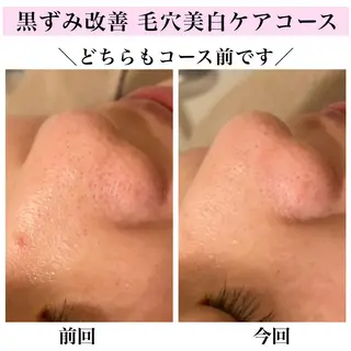 Bellesthe (ベルエステ)のエステ・リラクイメージ