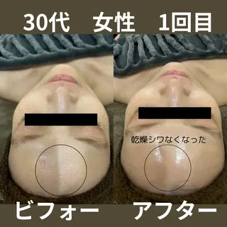 NiU.BEAUTY🥥池袋店所属・ハーブピーリング専門 NiU.BEAUTYのエステ・リラクイメージ