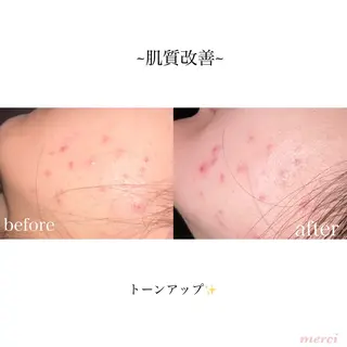 salon merci和泉のエステ・リラクイメージ