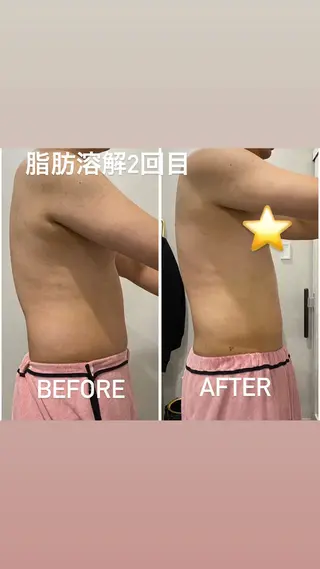 毛穴洗浄・痩身・脱毛 /アルカンジュのエステ・リラクイメージ