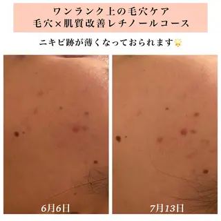 Bellesthe (ベルエステ)のエステ・リラクイメージ