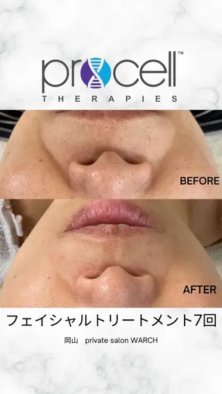 WARCH Marieのその他イメージ