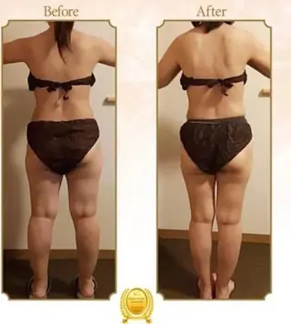 所沢痩身小顔コルギ AromaQueenのエステ・リラクイメージ