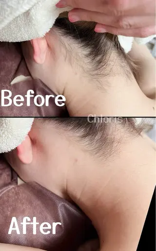 川越ローマピンク 光脱毛＆ワックス脱毛のエステ・リラクイメージ