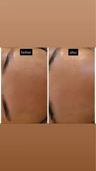 Luce所属・Luce Shokoのエステ・リラクイメージ