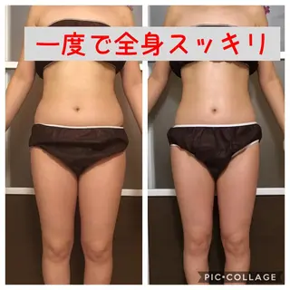 ミディアム カラー パーマ ヘアアレンジ メンズ キッズ ネイル マツエク・マツパ アニメ,Vオタク× 即効痩せエステサロンのエステ・リラクイメージ