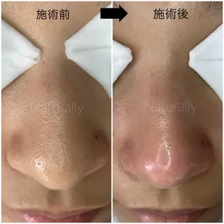 Naturally ナチュラリーのマツエク・マツパデザイン