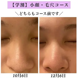 Bellesthe (ベルエステ)のエステ・リラクイメージ