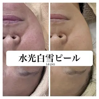 肌質管理専門店 Lé pia　AMIのエステ・リラクイメージ