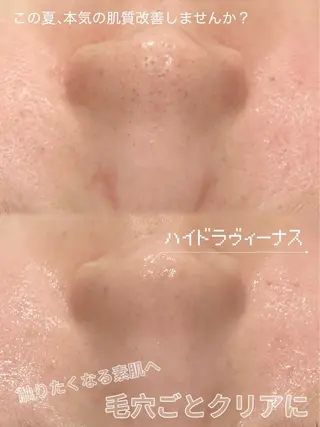 Unknown.姫路所属・Unknown.姫路 kanaのエステ・リラクイメージ