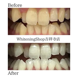 ホワイトニング ショップ吉祥寺店のエステ・リラクイメージ