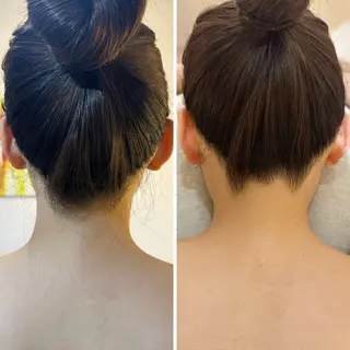 うなじ脱毛/美肌脱毛 LABELのエステ・リラクイメージ