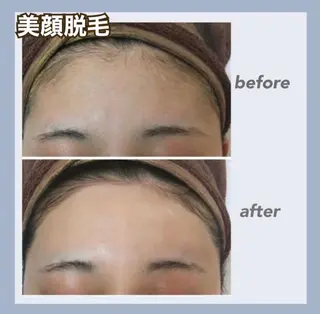 RAYVIS 郡山店のエステ・リラクイメージ