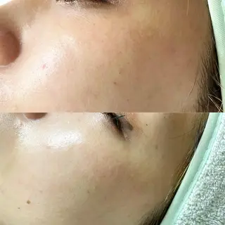 sara lazo 県病院前のマツエク・マツパデザイン