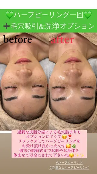 メンズ Salon de Lino 御器所のエステ・リラクイメージ