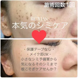 シミケアサロン REVIASオーナーのエステ・リラクイメージ